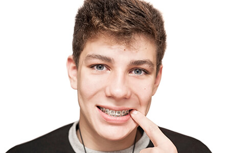 Teen with braces